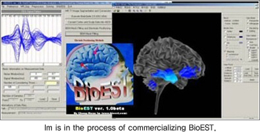 Deciphering the Secrets of the Brain