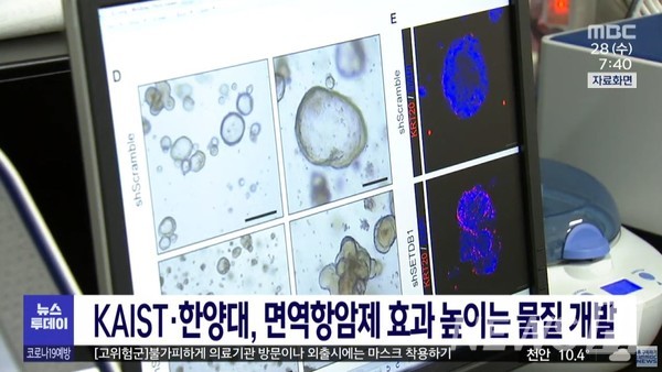 ▲ 윤채옥 교수의 연구 결과가 대전MBC에서 보도됐다 (ⓒ대전MBC 토토사이트 로그인 없이 캡처)