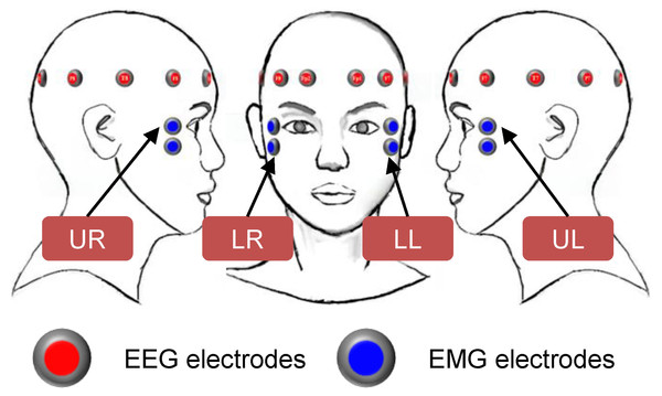 Locations of electrode attachments for brain waves and EMG measurement.