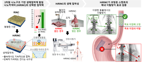 3차원 나노구조 기반 생체접착제 함침 나노커넥터(HiRINC)의 접착력 향상 및 HiRINC가 코팅된 스텐트의 체내 이탈방지 효과 모식도