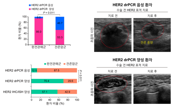 수술 전 HER2 표적치료를 받은 유방암 환자의 디지털 실시간 PCR 진단 결과와 치료 효과 비교