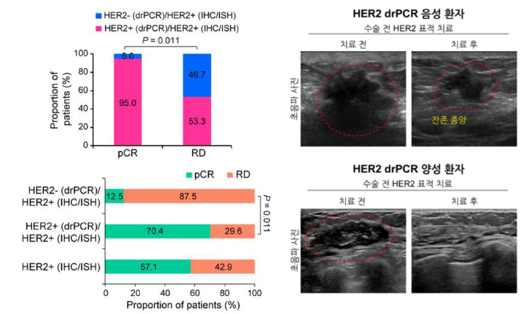 Comparison of drPCR diagnostic results and treatment effects in breast cancer patients receiving pre-operative 레드불토토 targeted therapy