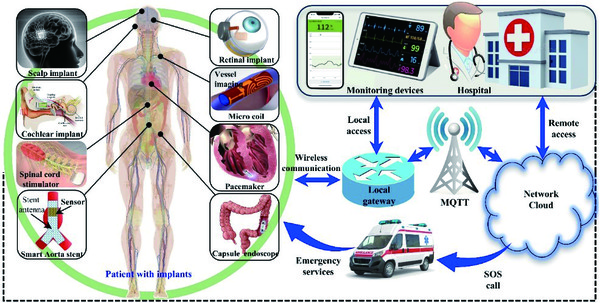 ▲ 유형석 교수는 인체를 중심으로 한 지능형 토토사이트 즐벳 생태계, ‘인간 중심(Human-Centric) 6G IoMT(Internet of Medical Things)’ 개발을 목표로 삼고 있다. 사진은 관련 연구 이미지.